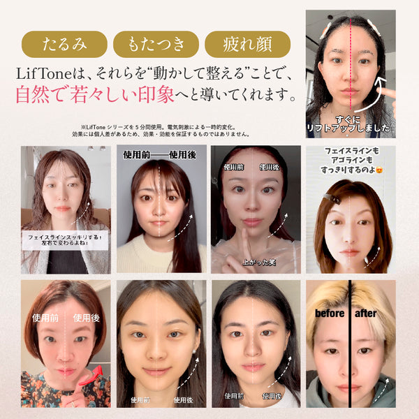 リフトーン美顔器 Amazon.co.jp: LifTone Premium (ブラック) リフトーン 1台で顔・頭皮
