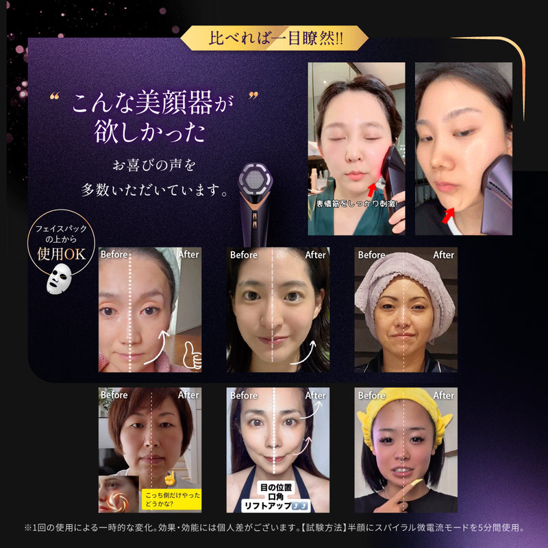 NOWMI LAB スパイラルケア美顔器STORM