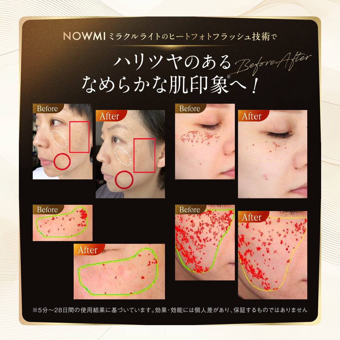 熱光護理美容儀 NOWMI LAB Milk Light PIR 360